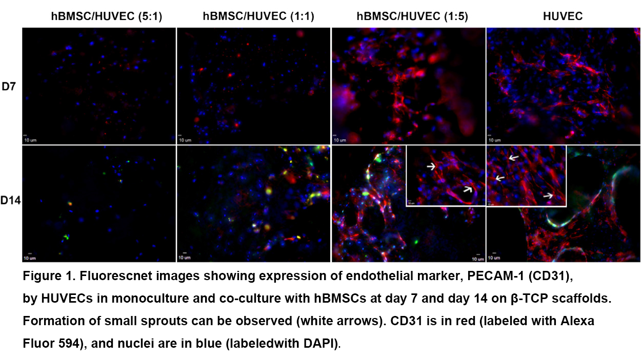 Frontiers Vascularization Of B Tricalcium Phosphate Scaffolds For Bone Tissue Regeneration